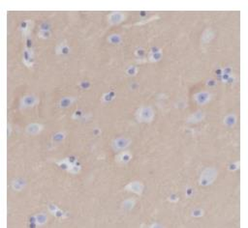 CD47 Recombinant Rabbit Monoclonal Antibody