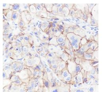 CD47 Recombinant Rabbit Monoclonal Antibody