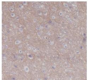 CD47 Recombinant Rabbit Monoclonal Antibody
