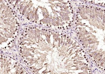 IGF2BP1 Rabbit Polyclonal Antibody