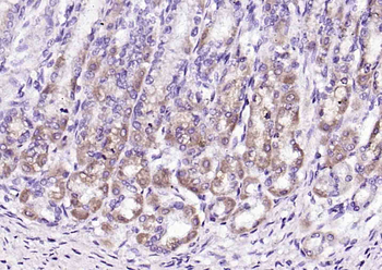 Laminin 2 alpha Rabbit Polyclonal Antibody