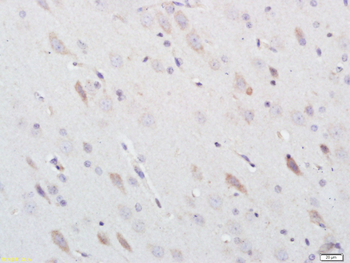 3-Nitrotyrosine Rabbit Polyclonal Antibody