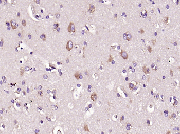 C-Kit Rabbit Polyclonal Antibody