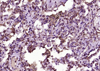 C-Kit Rabbit Polyclonal Antibody