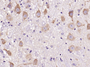 C-Kit Rabbit Polyclonal Antibody