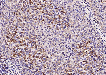 C-Kit Rabbit Polyclonal Antibody