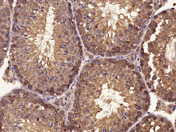C-Kit Rabbit Polyclonal Antibody