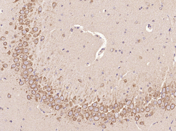 C-Kit Rabbit Polyclonal Antibody