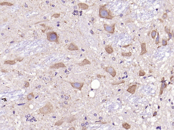 C-Kit Rabbit Polyclonal Antibody