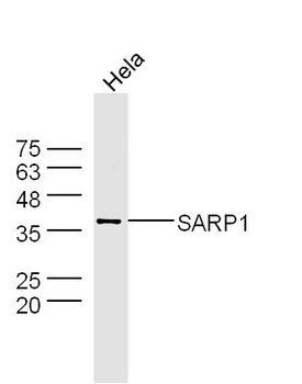 SARP1 Rabbit Polyclonal Antibody