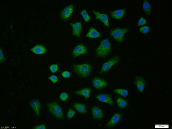 Desmin Rabbit Polyclonal Antibody (FITC)