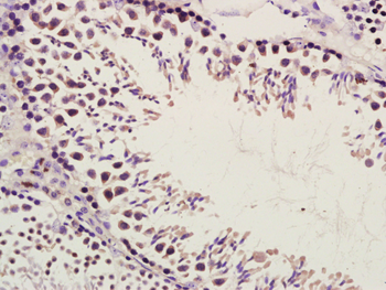 Phospho1 Rabbit Polyclonal Antibody