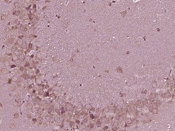 14-3-3 Tau Rabbit Polyclonal Antibody