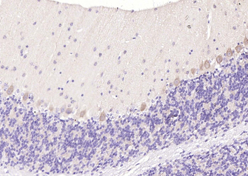 5HT7 Receptor Rabbit Polyclonal Antibody