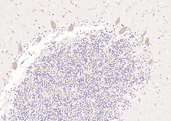 5HT7 Receptor Rabbit Polyclonal Antibody