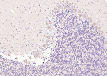 5HT7 Receptor Rabbit Polyclonal Antibody