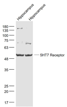 5HT7 Receptor Rabbit Polyclonal Antibody