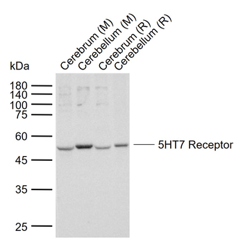 5HT7 Receptor Rabbit Polyclonal Antibody