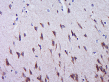 Phospho-ACACA (Ser79) Rabbit Polyclonal Antibody