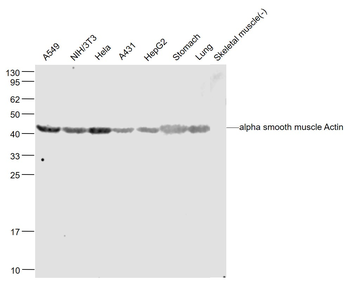 Alpha smooth muscle Actin Rabbit Polyclonal Antibody
