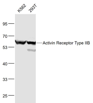 Activin Receptor Type IIB Rabbit Polyclonal Antibody