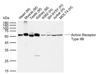 Activin Receptor Type IIB Rabbit Polyclonal Antibody