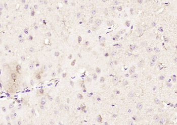 ADH5 Rabbit Polyclonal Antibody
