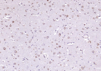 ADRM1 Rabbit Polyclonal Antibody