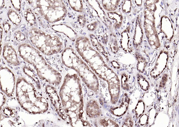ADRM1 Rabbit Polyclonal Antibody
