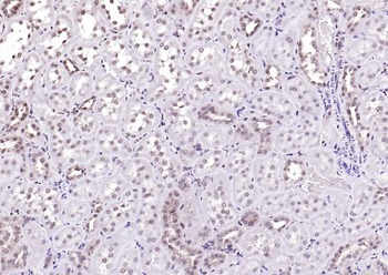 ADRM1 Rabbit Polyclonal Antibody