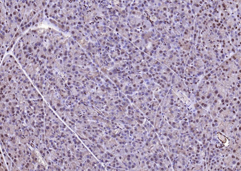 ADRM1 Rabbit Polyclonal Antibody