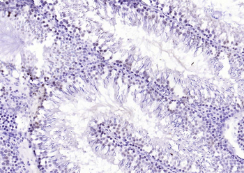 ADRM1 Rabbit Polyclonal Antibody