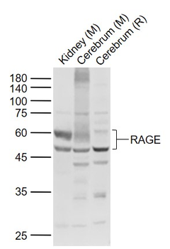 RAGE Rabbit Polyclonal Antibody
