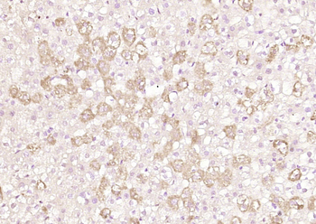 AGPS Rabbit Polyclonal Antibody