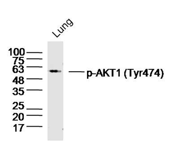 Phospho-AKT1 (Tyr474) Rabbit Polyclonal Antibody