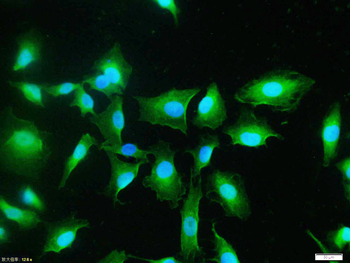 Phospho-AKT1 (Tyr474) Rabbit Polyclonal Antibody