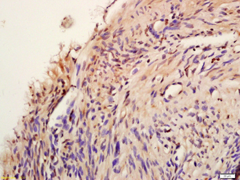 Phospho-AKT1 (Tyr474) Rabbit Polyclonal Antibody