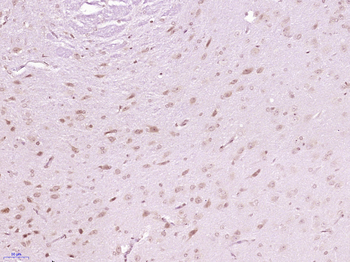 Phospho-AKT3 (Tyr473) Rabbit Polyclonal Antibody