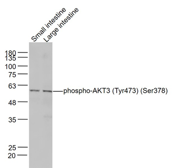 Phospho-AKT3 (Tyr473) Rabbit Polyclonal Antibody