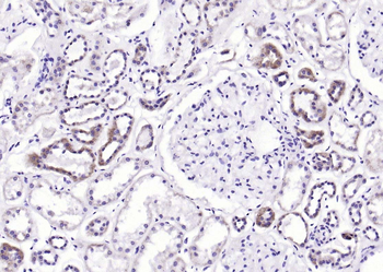 AKT1+2+3 Rabbit Polyclonal Antibody