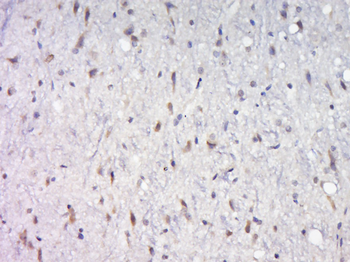 AKT1+2+3 Rabbit Polyclonal Antibody