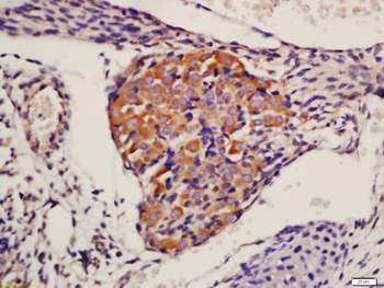 AKT1+2+3 Rabbit Polyclonal Antibody