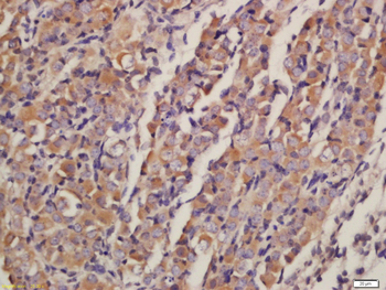 AKT1+2+3 Rabbit Polyclonal Antibody