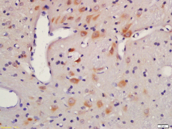 AKT1+2+3 Rabbit Polyclonal Antibody