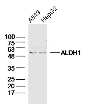 ALDH1A1 Rabbit Polyclonal Antibody