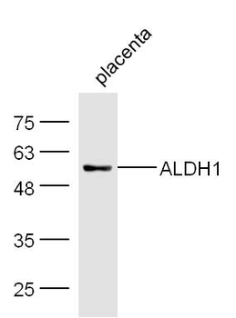 ALDH1A1 Rabbit Polyclonal Antibody