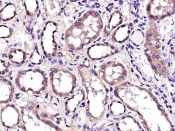ALDH3A2 Rabbit Polyclonal Antibody