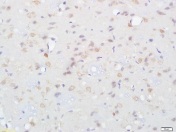 Alpha + beta Synuclein Rabbit Polyclonal Antibody