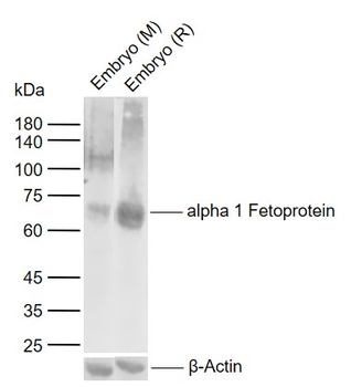 Alpha 1 Fetoprotein Rabbit Polyclonal Antibody
