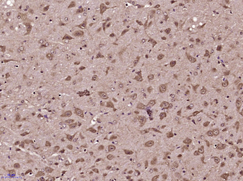 Phospho-alpha B Crystallin (Ser59) Rabbit Polyclonal Antibody